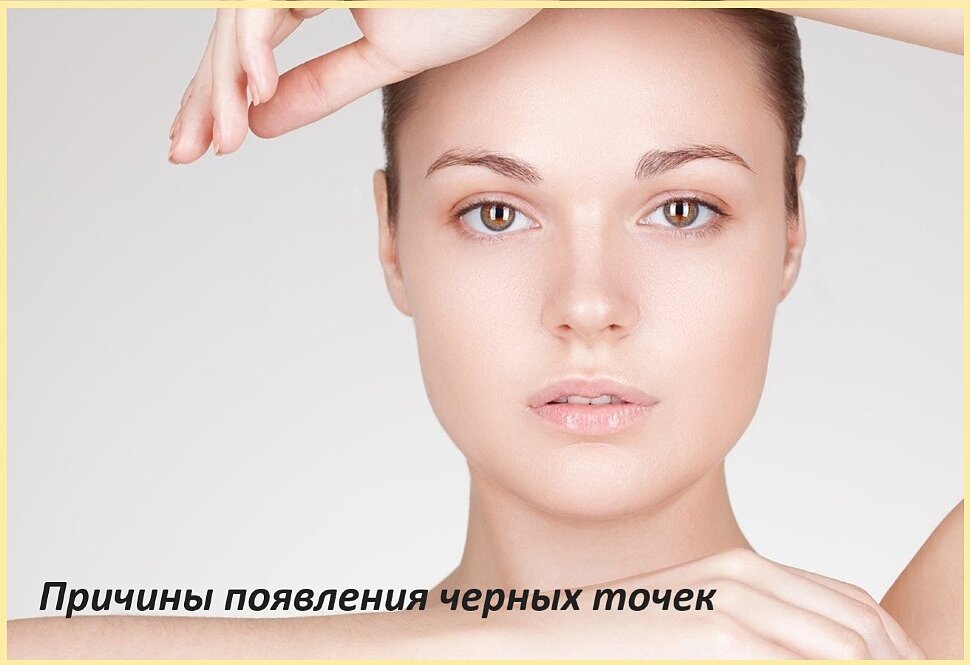 Причины появления черных точек Причины появления черных точек