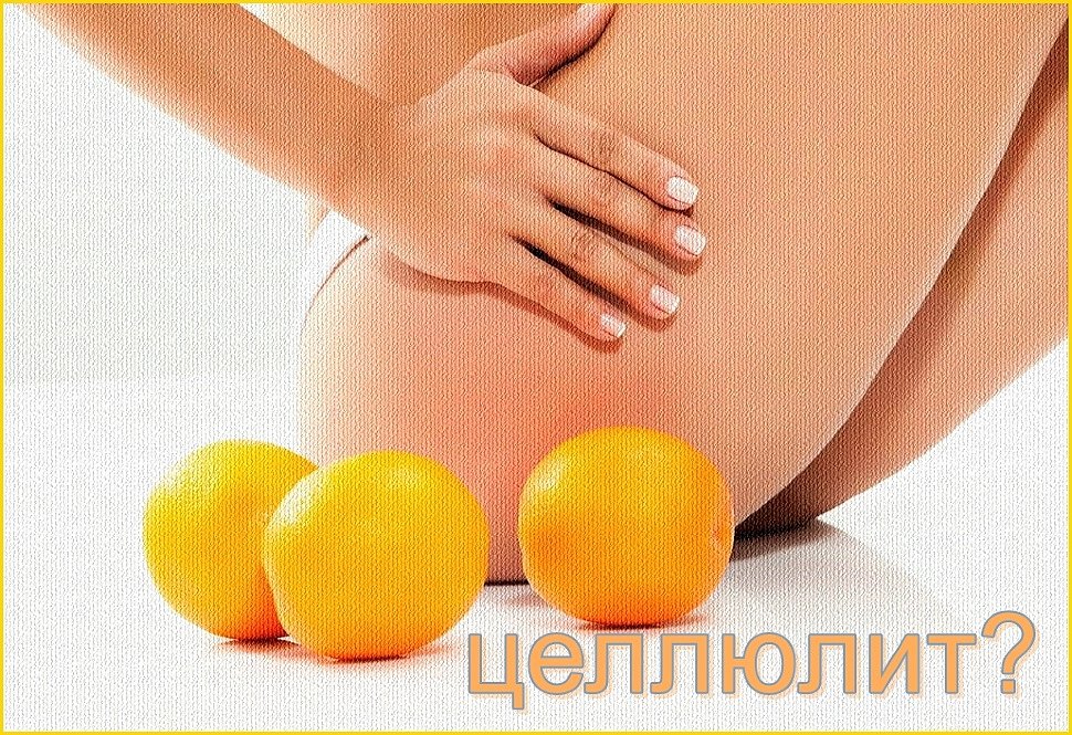 целлюлит?